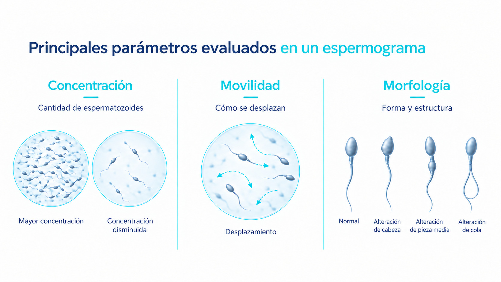 Principales parámetros evaluados en un espermograma: concentración, movilidad y morfología.
